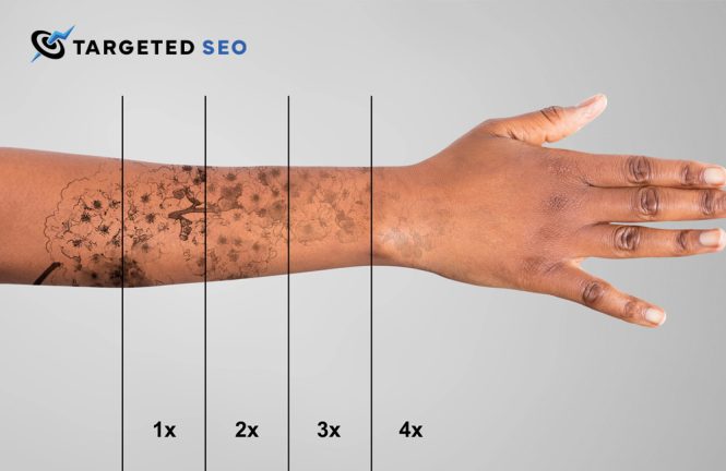 SEO for tattoo removal clinics